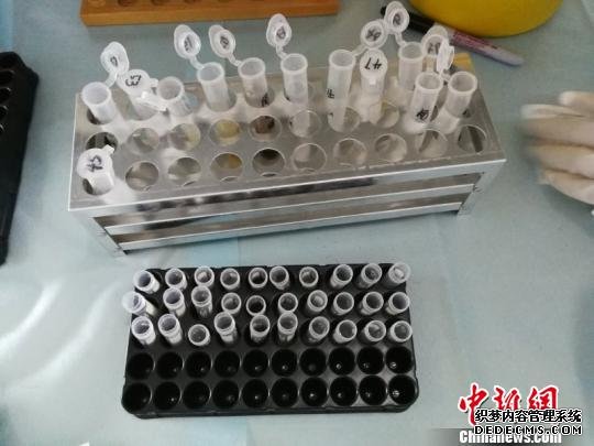 图为检测样本。　钟欣 摄